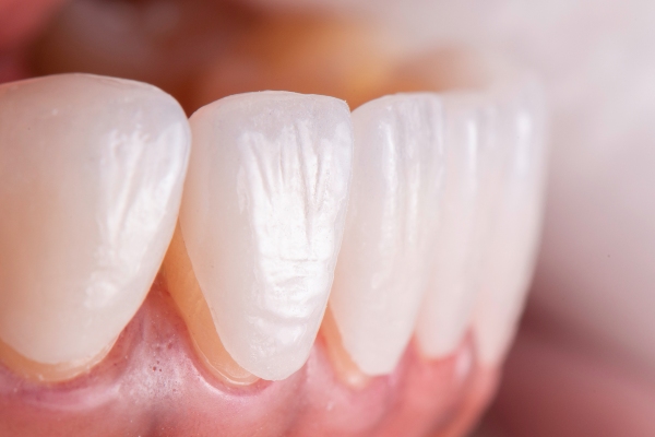 long-lasting dental crown